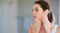 Cara Hilangkan Bekas Jerawat